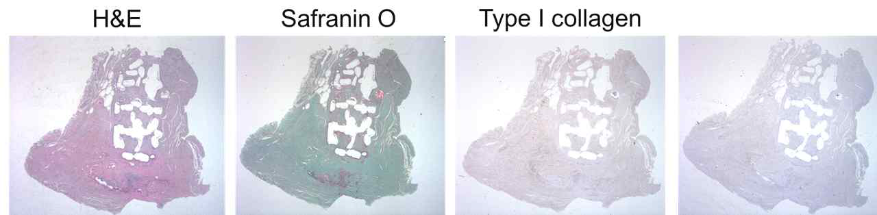 3차원 반월상 연골판 지지체의 미니어처 피그 이식 12주 후 조직학적 (H&E, Safranin O, Type I collagen, Type II