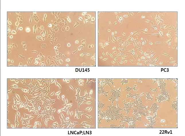 Prostate cancer cell line morphology