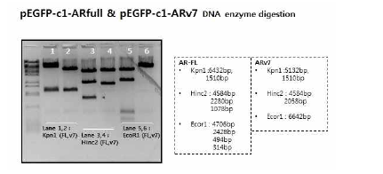 Restriction enzyme digestion 결과