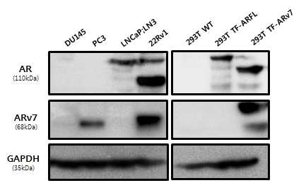 Prostate cancer cell 에서의 ARFL/ARv7 gene protein 발현 확인