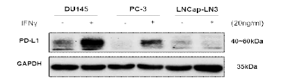 IFNγ 20ng/ml 48hr 처리 후 PD-L1 발현 결과