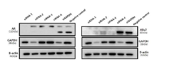 Western blots 상에서의 ARv7 siRNA knocking down 효율 비교