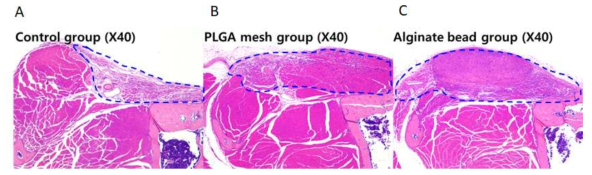 지지체 이식 없는 결손 부위를 보여주는 대조군 채취 결과 (A) 및 PLGA knitted mesh (B)와 Alginate bead 지지체 (C)를 이식한 4주 후 결손 부위. 지지체 이식한 부위에서 신생 재생 조직 형성이 관찰됨
