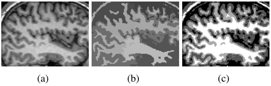 딥 러닝 기반 뇌영상 segmentation 결과(b) 및 Active Contour Model을 통한 영역 분할 결과(c)