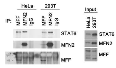 면역침강법을 이용하여 STAT6와 MFN2 가 결합함을 확인