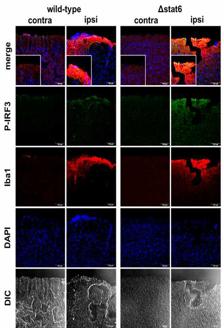 CCI 3일 후 확인한 WT-, STAT6-/- 생쥐에서의 뇌염증. CCI 3d 에 생쥐별 손상정도를 apoptosis marker 인 caspase 3 와 7으로 확인한 결과, 기존의 보고와는 달리 STAT6-/- 생쥐에서 IRF-3 의 증가, Iba1 의 발현 증가와 같은 염 증반응의 강화가 나타남