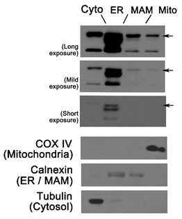 STAT6단백의 세포내 분포. ER; 소포체, MAM: mitochondria- associated ER membrane, Mito; 미토콘드리 아