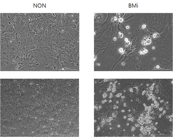 세포를 apoptosis 를 억제 후 caspase 를 억 제하면 vacuole을 형성하는 전형적인 pyroptosis 세포 사를 보임