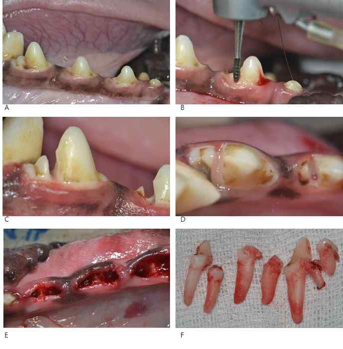 비글 하악 제 2, 3, 4 소구치 발거 과정