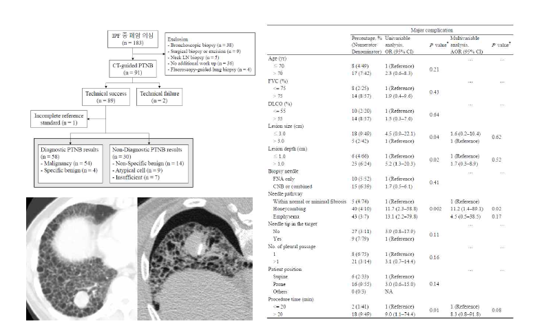 폐암 환자의 진단 시술에 대한 연구