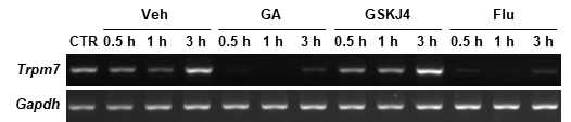 Gallic acid, GSKJ4, Fluoxetine에 의한 bEnd.3에서의 OGD 후 TRPM7 발현 변화 양상. (A) RT-PCR for TRPM7