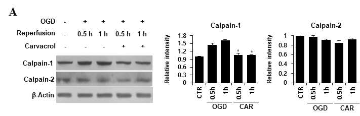 bEnd.3 cell에서 TRPM7과 척수혈관장벽 손상에 관여하는 인자에 대한 영향 확인. (A) Western blot Calpain-1 and Calpain-2