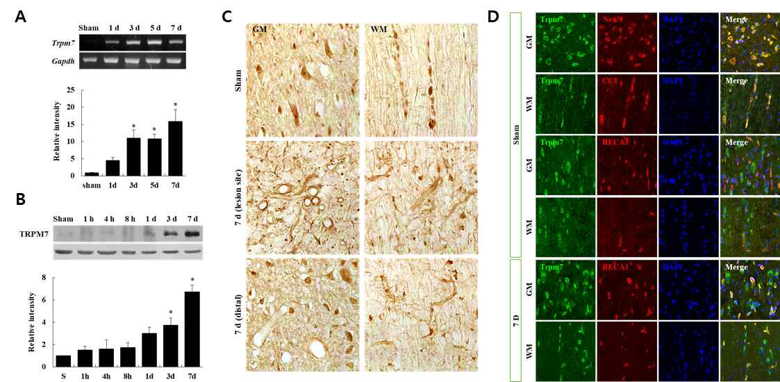 TRPM7의 시공간적 발현 (A) RT-PCR, (B) Western blot, (C) Immunohistochemistry for TRPM7, (D) Double immunostaining for TRPM7 and cell markers (NeuN, CC1, RECA1)