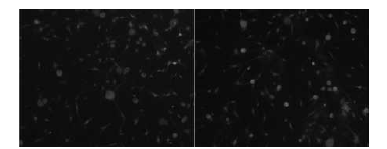 dorsal root ganglia에서 Fura-3이용한 칼슘이 미징