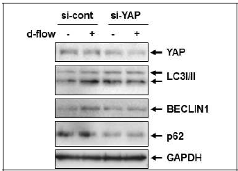 YAP 발현 조절을 통한 EC autophagy 신호체계의 변화 분석