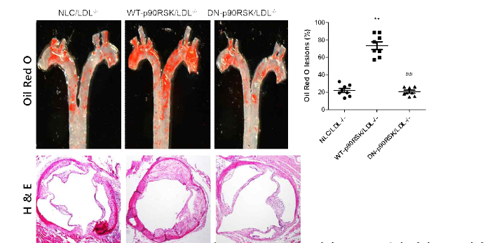 Hyperlipidermic(고지질식이) 동맥경화증 유발 동물모델에서 p90RSK 활성 제어 후 동맥경화 병변 확인