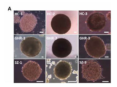 HC, GHR, SZ에　속한　모든　９명의　 ADSC 유래 iNSC가　신경구를　 형성함을　확인． (scale bar : 100μm) HC: Healthy Control (대조군) GHR: Genetic High Risk (유전적 고위험군) SZ: Patient with Schizophrenia (조현병 환자군)