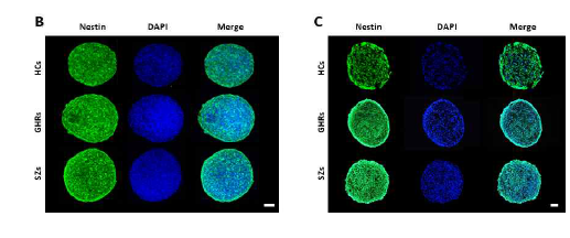 형광 염색을 통해 HC, GHR, SZ의 hADSC에서 분화유도된 iNSC 신경구에서 NSC 마커인 Nestin의 발현을 확인. Green : Nestin Blue : DAPI (scale bar : 100μm)