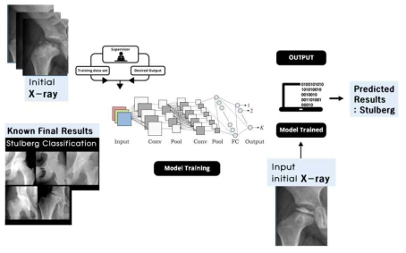 지도 학습(Supervised learning)을 이용하여 초기 X-ray로부터 최종 Stulberg결과를 예측하는 모델