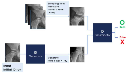 생성적 적대 신경망(GAN)모델의 Discriminator와 Generator구조를 활용한 최종 X-ray 생성 모델