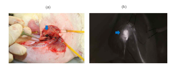 실제 토끼 모델의 슬와부 림프절 및 ICG 림프 조영술을 통해 확인한 림프 배 액 흐름