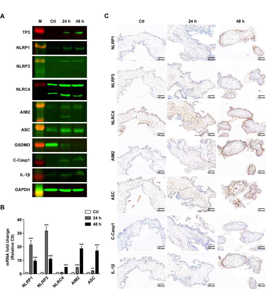 T. gondii induced activation of inflammasomes and pyroptosis within human placental villi. Human placental villi were isolated and freshly harvested T. gondii tachyzoites (2×105/well) were added directly to the villi culture system and infected for 24 h and 48 h. (A) The protein expression of TP3, NLRP1, NLRP3, NLRC4, AIM2, ASC, GSDMD, cleaved caspase-1 and IL-1β levels were detected by fluorescent western blotting. (B) Expression of indicated mRNA expression was evaluated by qRT-PCR. Each PCR reaction was carried out with three parallels. **P < 0.01, ***P < 0.001 compared with mock-infected control cells. (C) The protein expression of NLRP1, NLRP3, NLRC4, AIM2, cleaved caspase-1 and IL-1β in T. gondii-infected placental villi tissue was detected by immunohistochemistry