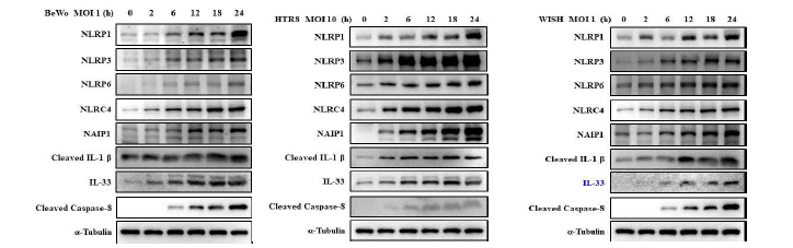 Changes in the expression NLR and inflamasome components protein levels in response to T. gondii infection in placenta-derived cells