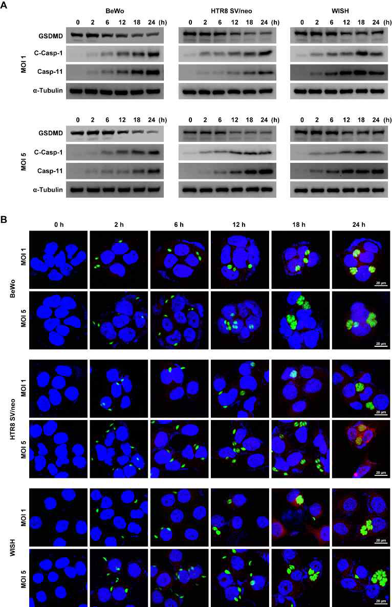 T. gondii induced the pyroptosis in the placental cells. BeWo, HTR8 SV/neo and WISH cells were infected with T. gondii at MOI of 1 and 5 for 0, 2, 6, 12, 18 and 24 h. (A) The protein levels of pyroptosis related proteins were assessed using western blotting. Anti-α-tubulin was used as internal control. (B) Cells were stained with cleaved caspase-1 antibody and detected under a confocal microscope. Representative confocal images of cleaved caspase-1 expression as red fluorescence