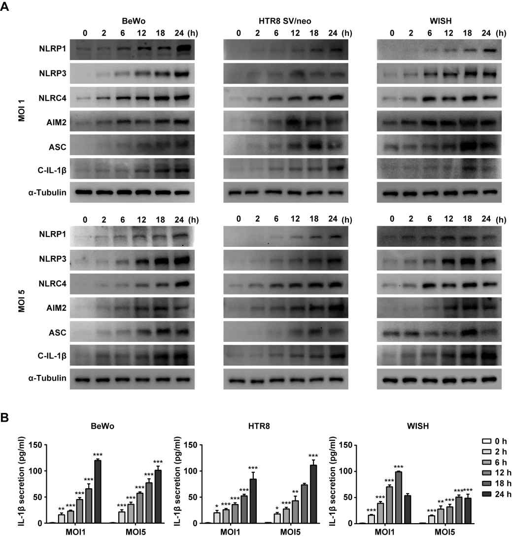 T. gondii infection induced activation of inflammasomes in the placental cells. BeWo, HTR8 SV/neo and WISH cells were infected with T. gondii RH strain at MOI of 1 and 5 for 0, 2, 6, 12, 18 and 24 h. (A) The protein levels of inflammasome-related proteins were assessed using western blotting analysis. (B) The IL-1β secretion levels were evaluated by ELISA