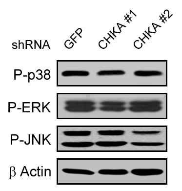 CHKA 발현 억제에 따른 MAPKs 활성화 영향