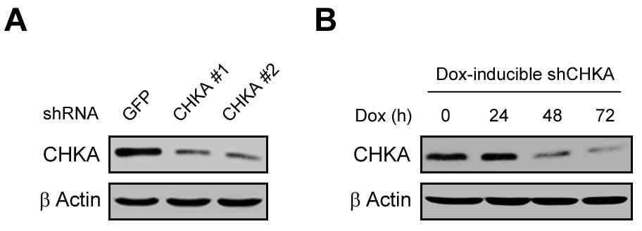 CHKA 발현 억제
