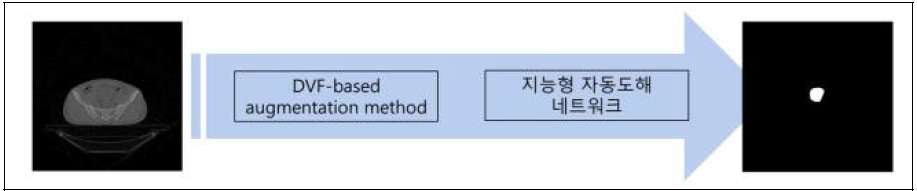 Deformable vector field (DVF)-based augmentation이 적용된 지능형 자동 도해 흐름도