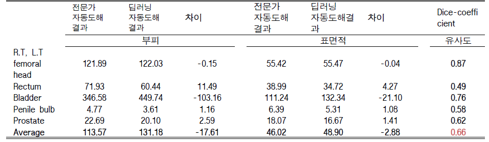 지능형 자동도해 네트워크를 이용한 전립선 암환자의 주변장기와 전립선의 자동도해 결과