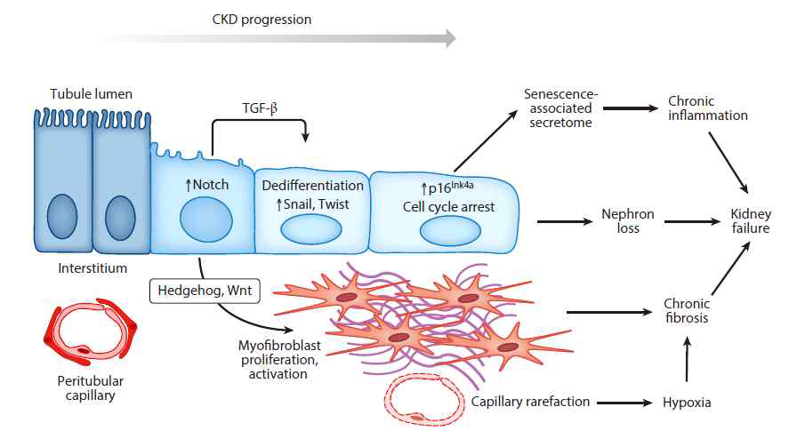 만성콩팥병에서 섬유화 유도 기전 [Benjamin DH. Annu Rev Physiol. (2018)]