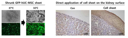 (선행연구 결과) GFP 발현 MSC의 세포 시트 제작 과정 (왼쪽), 신장 표면에 세포 시트 이식 14일 후 온전하게 유지됨을 조직면역염색(anti-Human Nuclei)으로 확인함 (오른쪽)