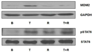비만세포의 세포증식에 있어서 RANKL 역할 규명을 위해 TSLP로 자극 후 MDM2와 pSTAT6의 발현 분석