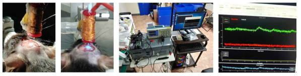 경두개 자기자극 및 섬유 광도법 측정법이 가능한 결합형 코일을 실험동물 뇌 부착하는 이미지(좌), 경두개 자기자극 및 섬유 광도법 측정장치(중앙), 결합형 코일을 이용해서 측정되는 형광 칼슘 신호(우)