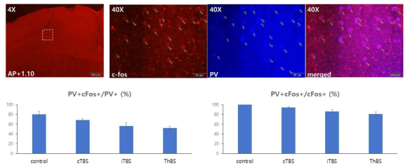 TMS 프로토콜별 PV발현 신경세포 및 c-Fos 발현 신경세포 비율 분석 (형광현미경 이미징)