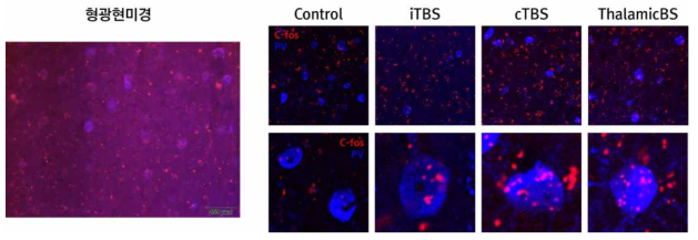 경두개 자기자극 프로토콜별 면역염색 기존 결과(좌: 형광현미경 이미지, 우: 콘포칼 이미지)