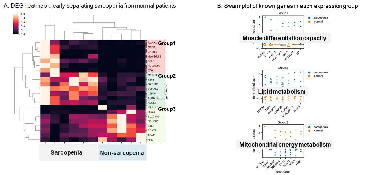 골근감소증 유무에 따른 DEG heatmap과 주성분 분석을 통한 발현 그룹 clustering