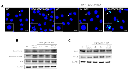 합성 HIF-1α/STAT5 decoy ODN의 비만세포 사멸 효능 확인. (A) TUNNEL 염색; (B) apoptosis 관련 단백 발현변화 확인; (C) anti-apoptosis 관련 단백 발현변화 확인