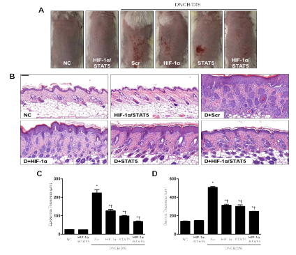 아토피피부염 동물모델에서 합성 HIF-1α/STAT5 decoy ODN의 효능. (A) 아토피피부염 동물모델의 등 육안사진; (B) 피부조직의 H (C) epidermis 두께 측정; (D) dermis 두께 측정