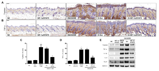 합성 HIF-1α/STAT5 decoy ODN의 비만세포 탈과립 및 항염증 효능. (A) tryptase 면역화학염색 사진; (B) TNF-α 면역화학염색 사진; (C) tryptase 면역화학염색 %면적 그래프; (D) TNF-α 면역화학염색 % 면적 그래프; (E) 아토피피부염 동물조직에서 tryptase, TNF-α, IL-1β, IL-4, TSLP 단백 변화 확인