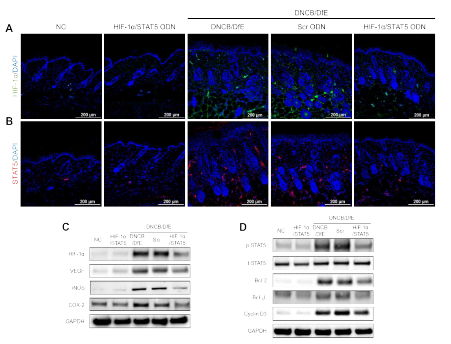 아토피피부염 동물모델에서 합성 HIF-1α/STAT5 decoy ODN의 효능. (A) HIF-1α 면역형광 염색; (B) STAT5 면역형광염색; (C) HIF-1α target 단백질 발현; (D) STAT5 target 단백질 발현