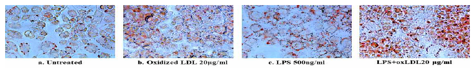 Oil-red O staining을 통한 foam cell 관찰