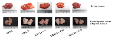 Representative images of liver and epididymal white adipose tissue