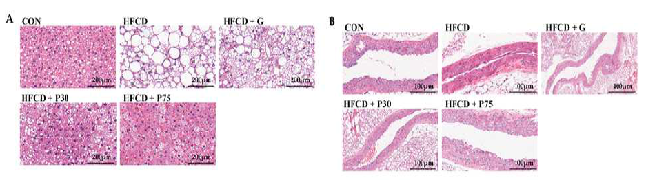 PEITC 식이보충이 마우스의 간 및 대동맥에 미치는 영향 : (a) 간 조직의 H (b) 대동맥의 H&E염색 (magnification 400x)