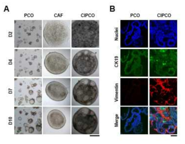 배양기간에 따른 CIPCO의 성장(A) 및 각 특이마커(Cancer: CK19, CAF: Vimentin)의 발현(B)