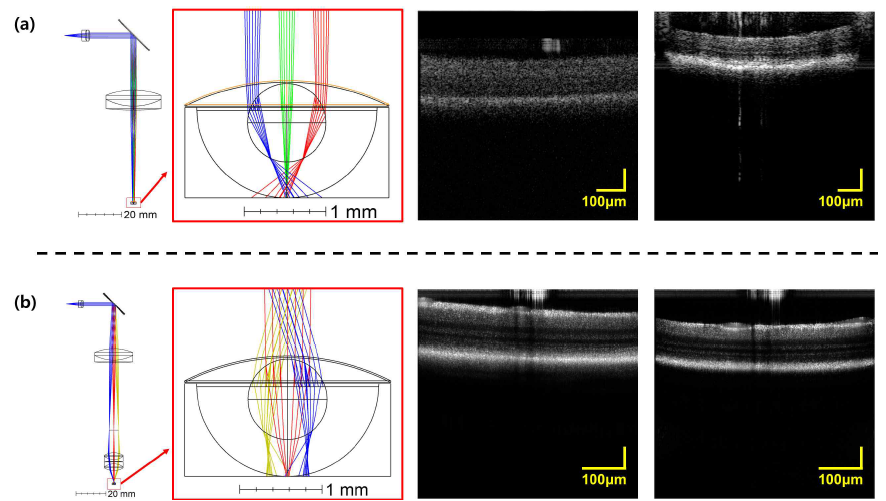 zebrafish 망막 영상 획득을 위한 probe 설계 (a) scan lens만 이용한 probe, (b) scan lens 및 망막용 objective pair를 적용한 probe