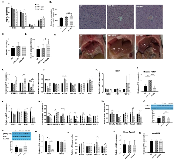 Transplantion of fecal microbiota from colitis mice disrupted hepatic lipid metabolism in the recipient GF mice. (기타 구체적인 figure legend는 생략)